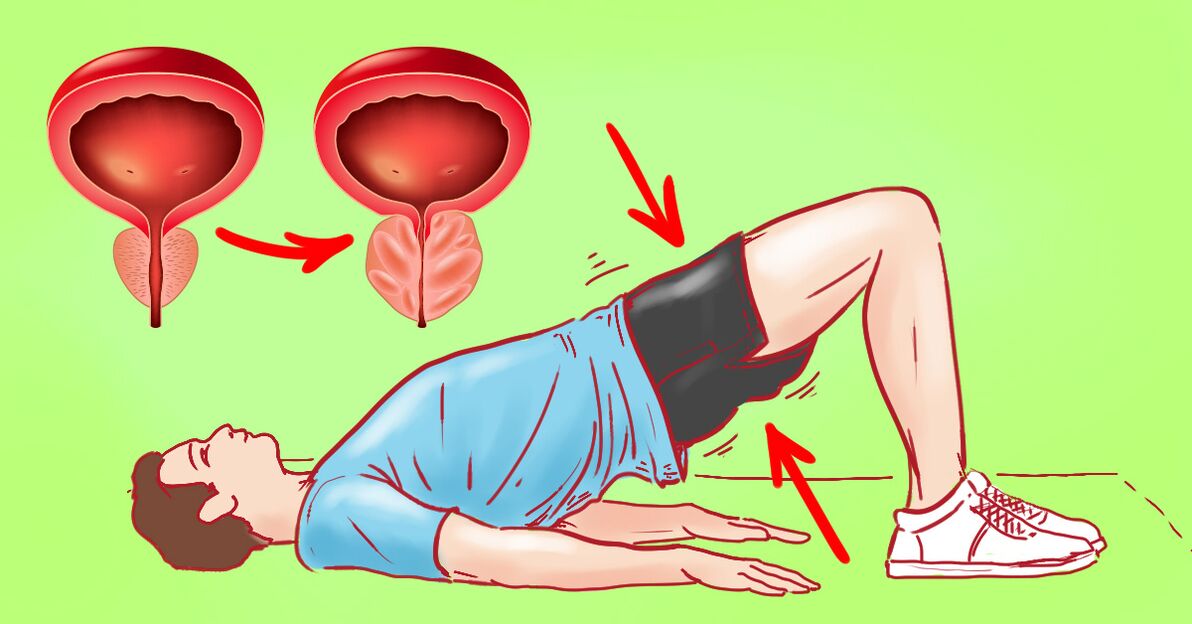 exercices de gym pour la prostatite